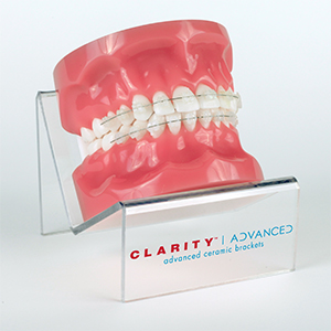 Clarity